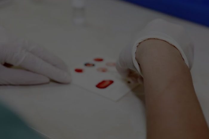 application-dry-blood Application for dried blood analysis